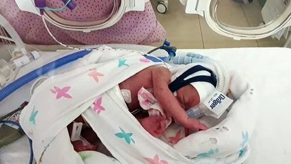 'There were questions about his survival - but he made it'