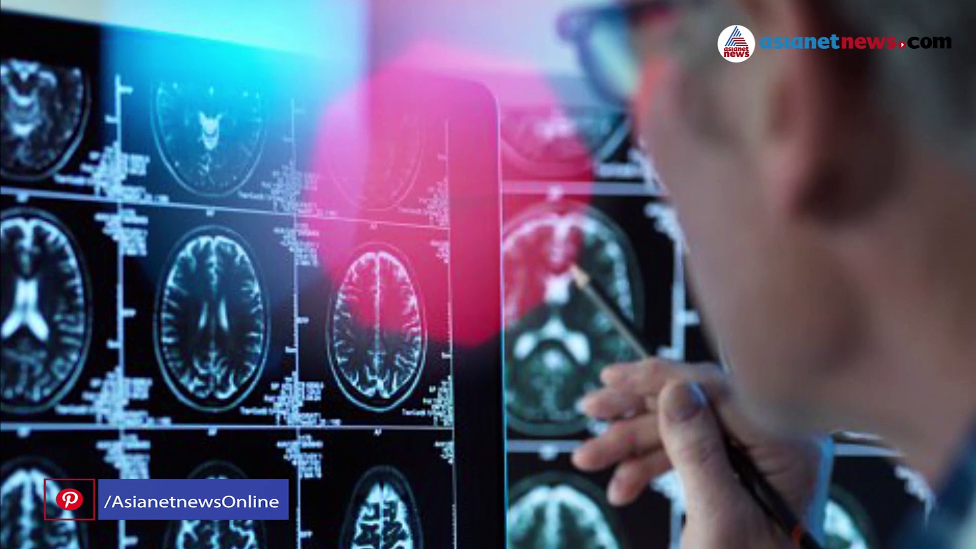 കാഴ്ച വൈകല്യത്തിന് ചികിത്സ തേടിയെത്തി, പരിശോധനയില്‍ തലച്ചോറിലെ ഞരമ്പിന് ക്ഷതം;കൊവിഡ് ഭീഷണിയാകുന്നു