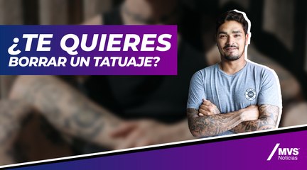 ¿Te quieres borrar un tatuaje?