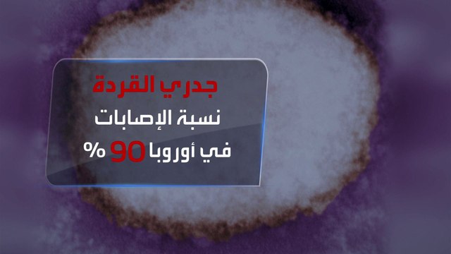 لماذا تحذر الصحة العالمية من تفشي جدري القردة في أوروبا؟