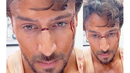 Tiger Shroff Injured Video Viral,Fans हुए परेशान | Boldsky *Entertainment