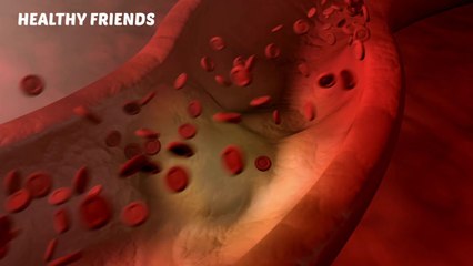 15 FOOD TO PREVENT ARTERIAL BLOCKAGE,HEALTHY HEART | HEALTHY FRIEND | BESTIE