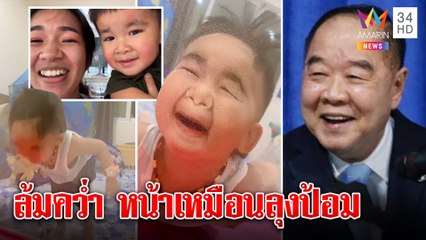 เหมือนไหม! เด็ก2ขวบหน้าเหมือน“บิ๊กป้อม” แม่ปัดเป็นญาติลูกล้มชนมุ้งเฉียด2ล้านวิว|ทุบโต๊ะข่าว|03/07/65