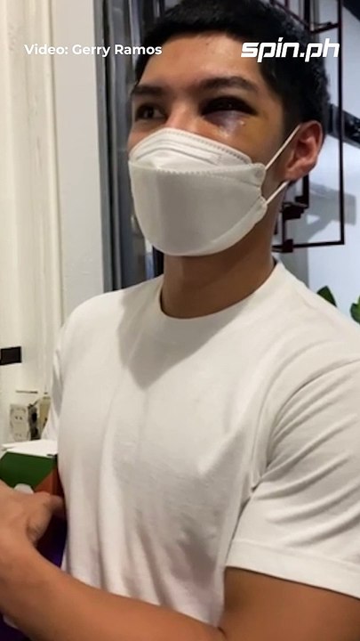 Kurt Lojera on his eye injury