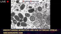 Understanding Monkeypox and How Outbreaks Spread - 1breakingnews.com