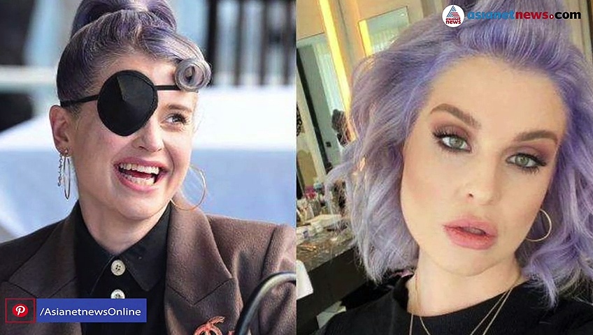 മസ്ക്കാര ബ്രഷ് കണ്ണിൽക്കൊണ്ടു; മുറിഞ്ഞ കണ്ണ് മറച്ച് താരം