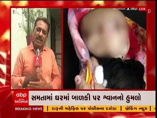 Vadodara: શ્વાનનો શિકાર બનેલી માસૂમની શું છે સ્થિતિ?, જુઓ આ વીડિયો