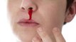 Nose Bleed Fever: इस बुखार में नाक से बहता है खून | नाक से खून क्यों निकलता है | Boldsky *Health