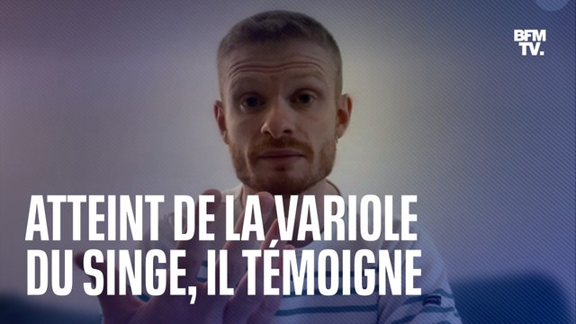 Atteint de la variole du singe, Corentin témoigne