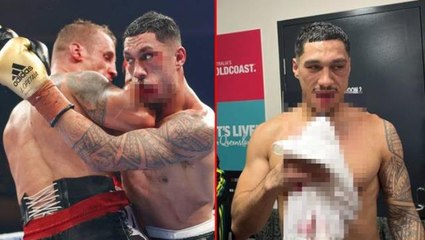 İnanılmaz ama gerçek! Ünlü boksörün çenesi dağıldı, yine de maçı bırakmadı