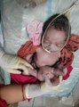 Hindistan'da 4 kollu ve 4 bacaklı doğan bebek ilgi odağı oldu! Halk, Hindu tanrısına benzettikleri bebeği görmek için evine akın etti
