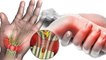 रात में हाथ दर्द क्यों होता है, Uric Acid बढ़ने से लेकर Calcium की कमी | Boldsky *Health