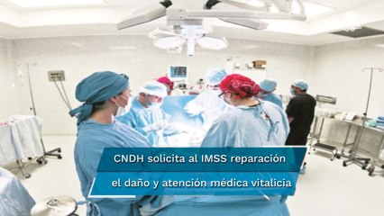 Por negligencia, le amputan piernas y extirpan útero a mujer en el IMSS; CNDH emite recomendación
