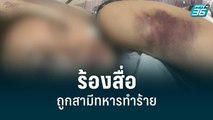 สาวร้องสื่อ ถูกสามีทหารยศ จ.ส.อ.ทำร้าย | โชว์ข่าวเช้านี้ | 7 ก.ค. 65