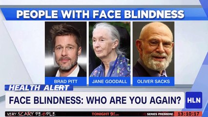 What is Facial Blindness (Brad Pitt Reportedly Has it)