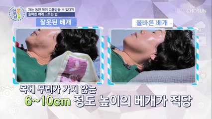 예방이 최고의 보약! 목 디스크 자가 진단법 大공개★ TV CHOSUN 20220707 방송