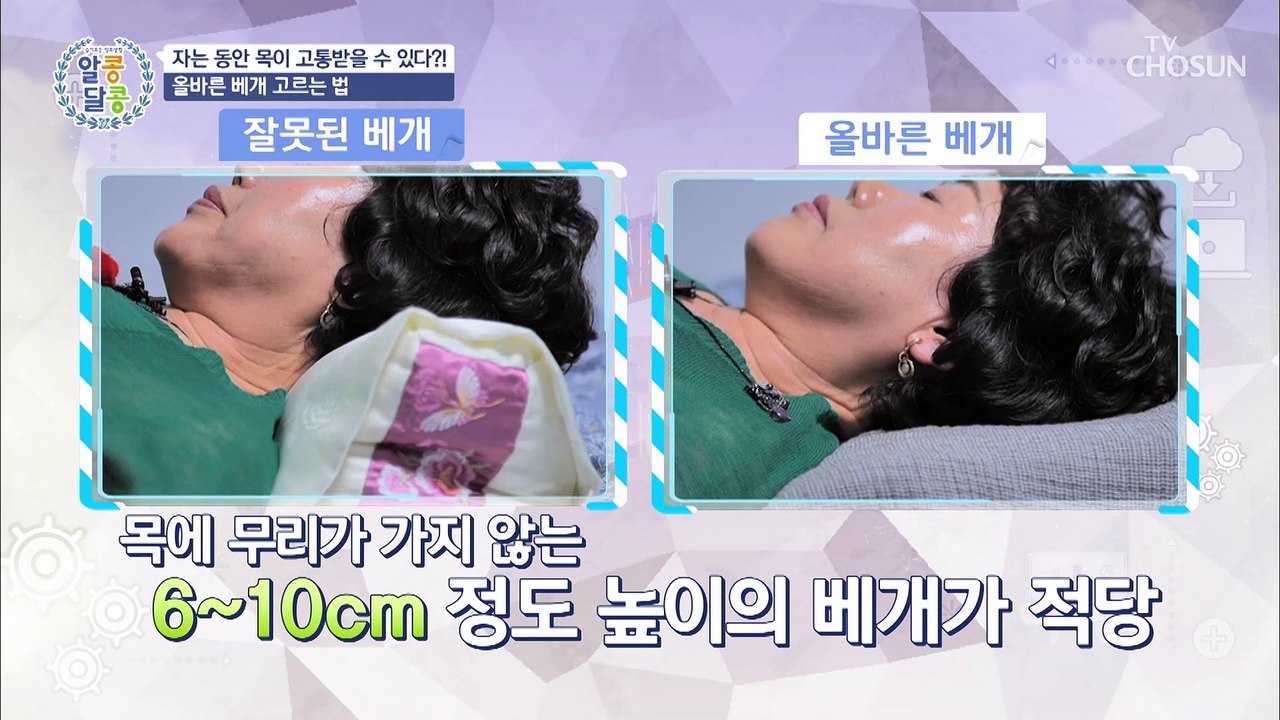예방이 최고의 보약! 목 디스크 자가 진단법 大공개★ TV CHOSUN 2022070...