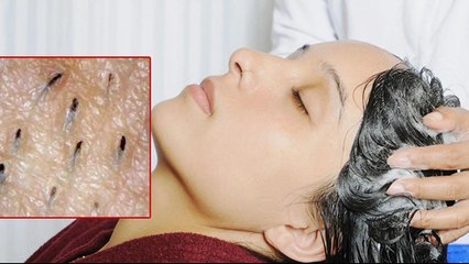 Scalp Facial क्या है | Scalp Facial Treatment क्यों करना चाहिए | Scalp Facial at Home | Boldsky
