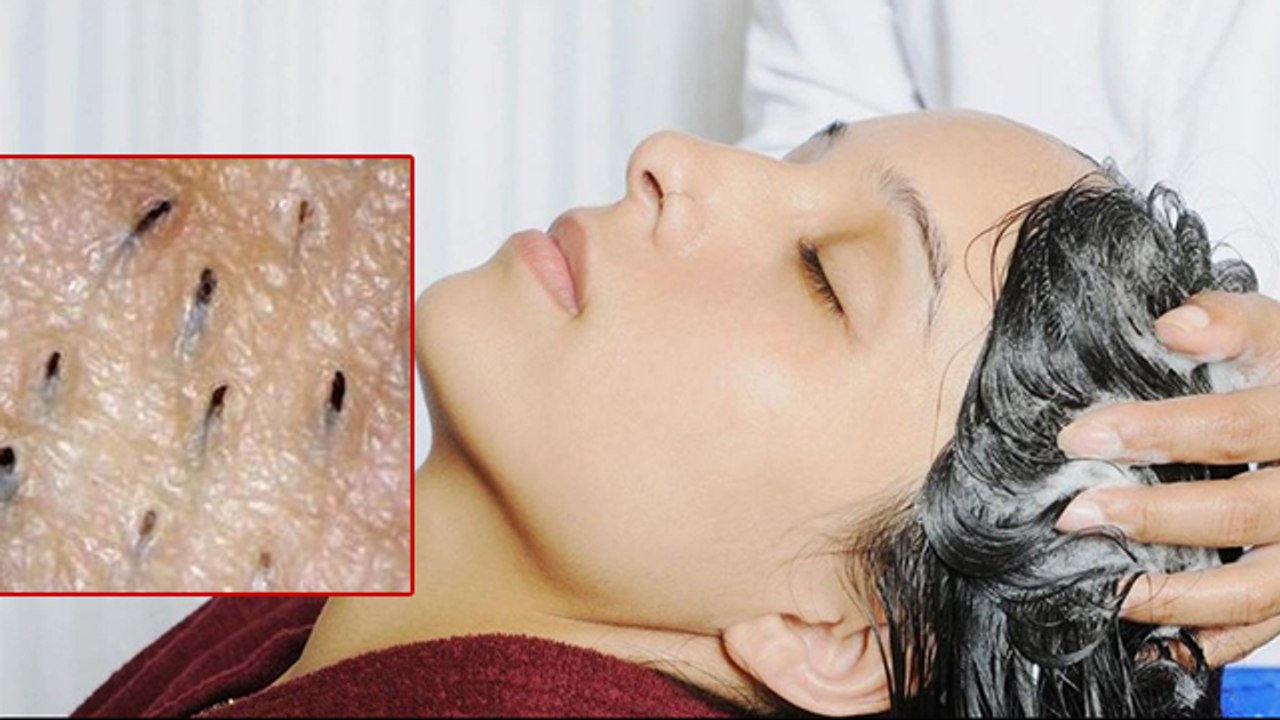 Scalp Facial क्या है | Scalp Facial Treatment क्यों करना चाहिए | Scalp Facial at Home | Boldsky