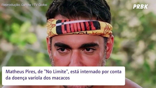 No Limite : Matheus Pires é internado com varíola dos macacos e fica fora da final