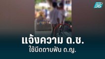 แจ้งความ ด.ช.ใช้มีดดาบฟัน ด.ญ.เป็นแผล | โชว์ข่าวเช้านี้ | 8 ก.ค. 65