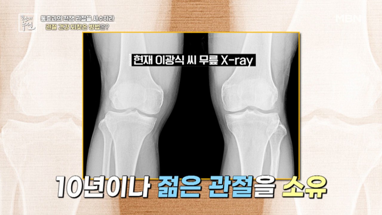 10년이나 젊은 관절 소유! 관절 건강 되찾은 특별한 비법의 정체는?