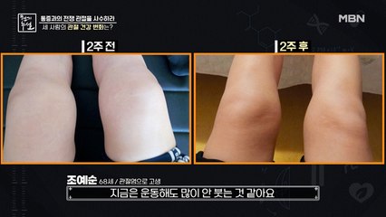 초록입홍합 오일 2주 프로젝트! 관절 건강의 변화는?