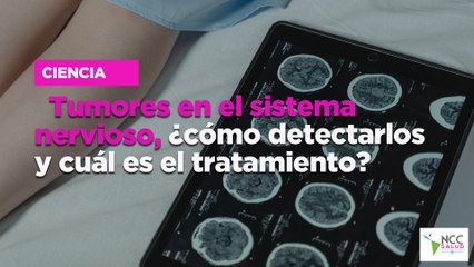Tumores en el sistema nervioso, ¿cómo detectarlos y cuál es el tratamiento?