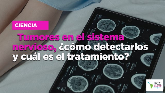 Tumores en el sistema nervioso, ¿cómo detectarlos y cuál es el tratamiento?