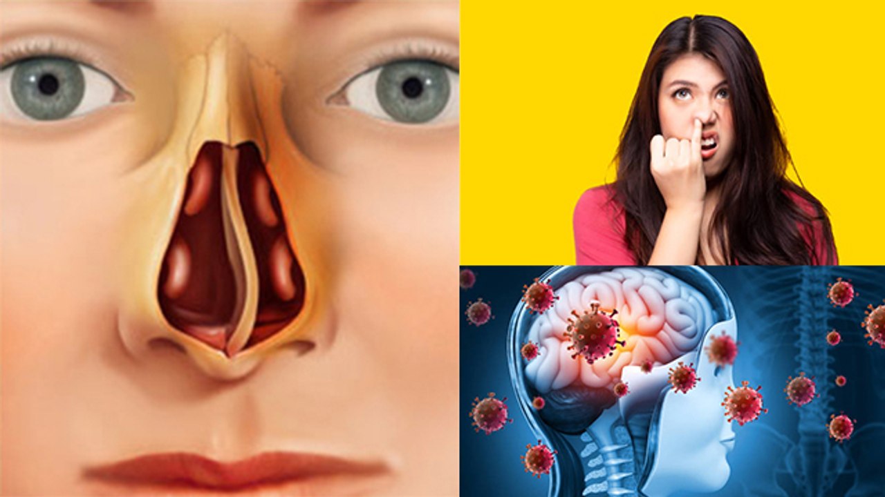 नाक मे उंगली डालने से क्या होता है | Nasal Septum Infection से लेकर Brain Damage का खतरा|*Health