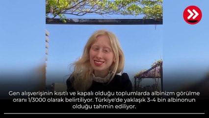 Adını 'beyaz melek' koydular! Yaşadıklarını anlattı, en çok sorulan soru...