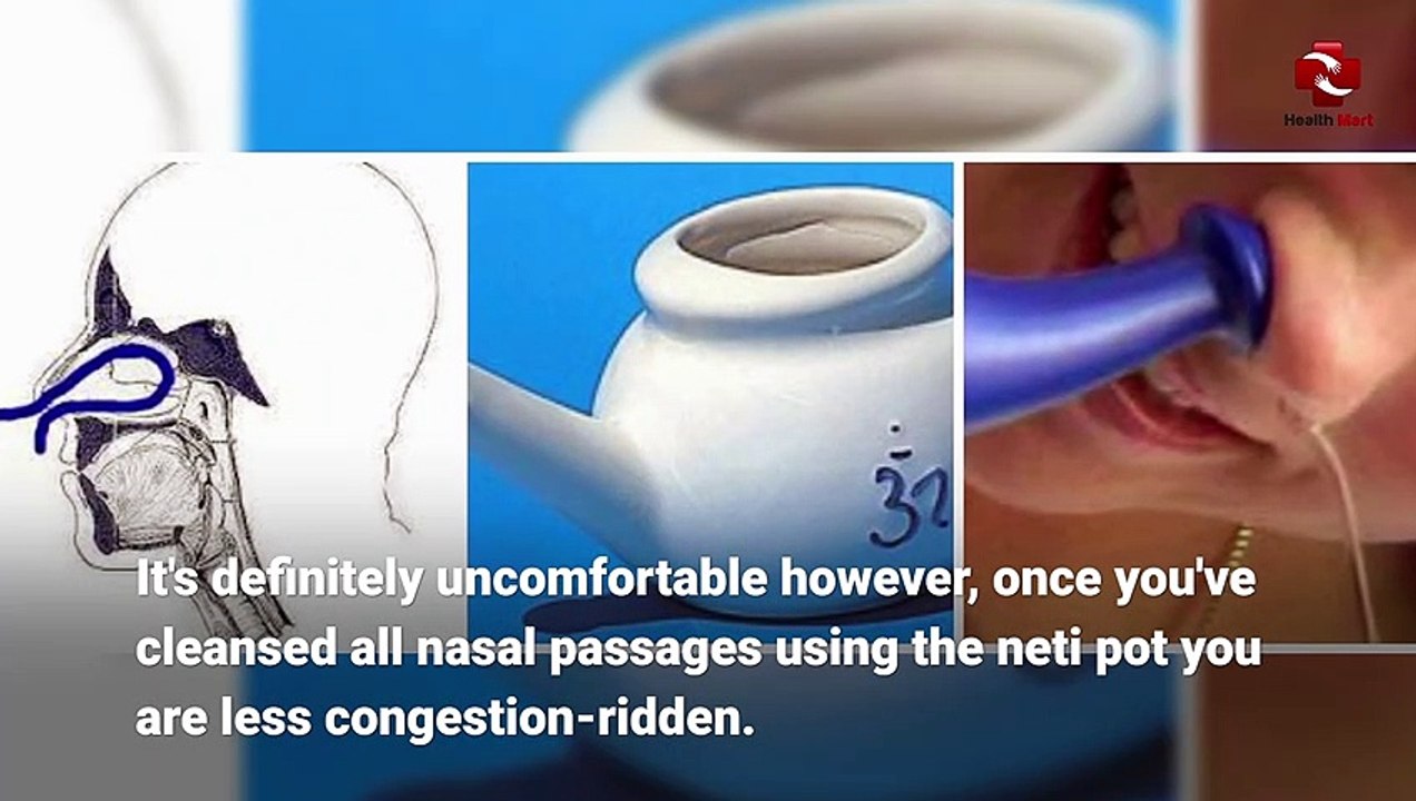 Home remedies for nasal allergies,