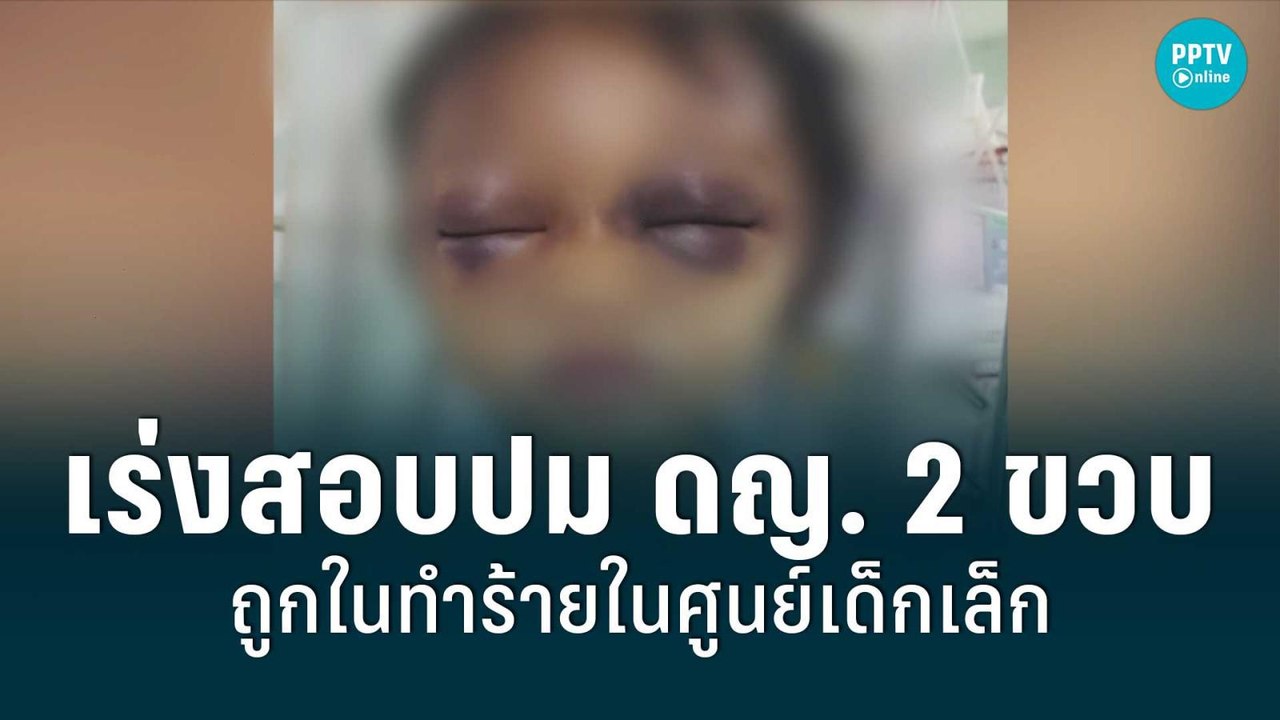 เทศบาลเร่งสอบกรณีเด็ก 2 ขวบถูกทำร้ายในศูนย์พัฒนาเด็กเล็กที่ จ.นครราชสีมา | เข้มข่าวค่ำ | 9 ก.ค. 65