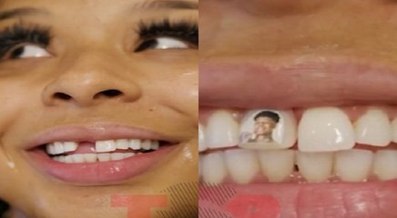 Chrisean Rock goes viral for getting Blueface's picture placed on her tooth