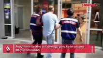 Sevgilisinin üzerine asit döktüğü genç kadın yaşama 38 gün tutunabildi