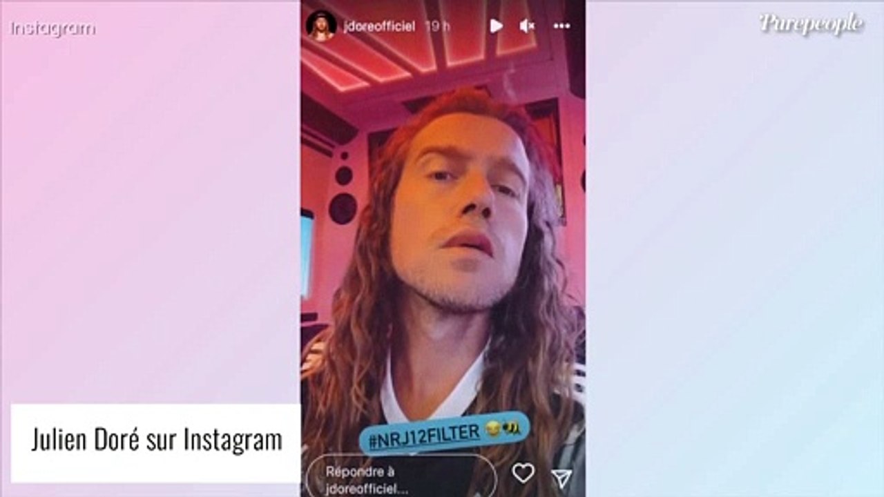 Julien Doré dévoile sa nouvelle bouche XXL : il s'explique sur sa mésaventure...