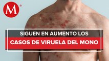 Se aceleran los contagios de viruela símica; México solo reporta 27