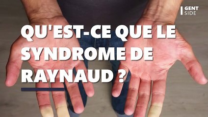 Syndrome de Raynaud : traitement, causes, diagnostic, de quoi s'agit-il ?