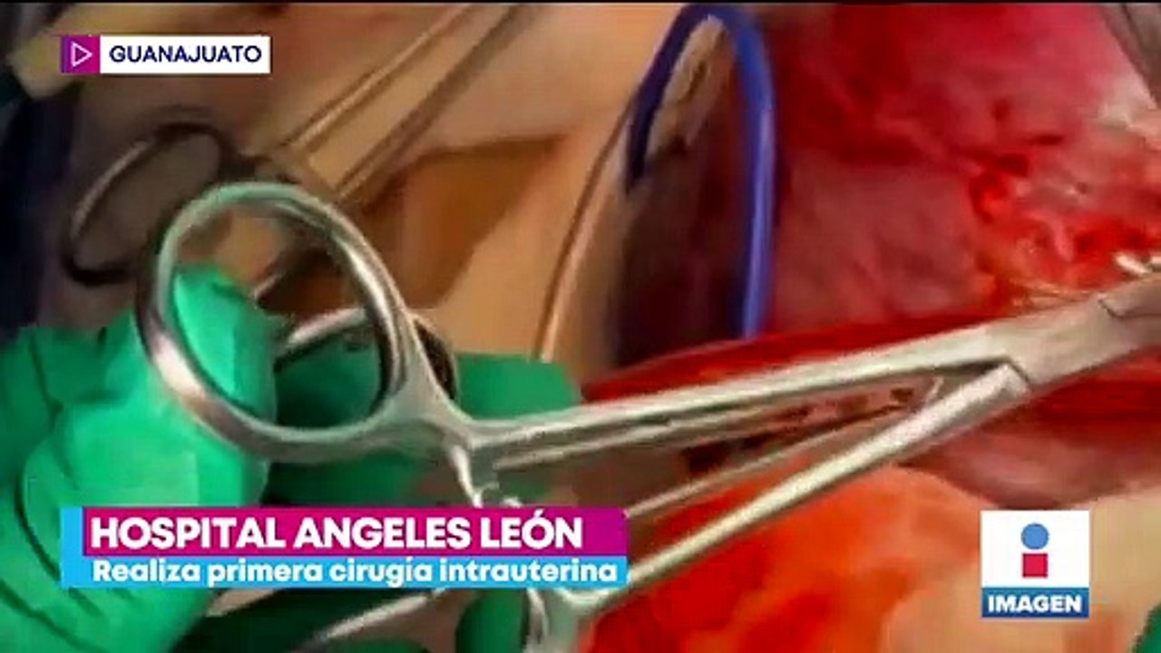 Hospital Ángeles León realiza primera cirugía intrauterina
