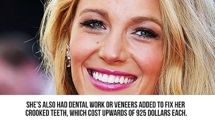 20 Celebs Who Spent A FORTUNE To Look Completely Different
