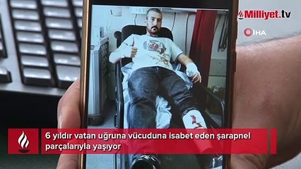 6 yıldır elindeki ve bacağındaki şarapnel ile yaşıyor