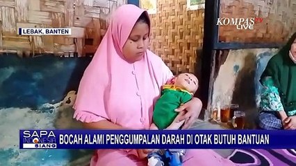 Muhammad Akbar, Bocah 4 Tahun di Lebak Alami Penggumpalan Darah di Otak Ini Butuh Bantuan Dermawan
