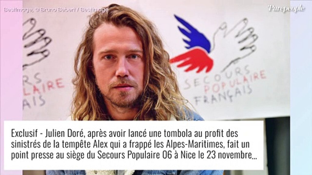 Julien Doré méconnaissable après une piqûre de guêpe, de nouvelles images dévoilées