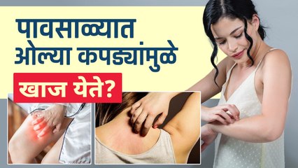 पावसाळ्यात ओल्या कपड्यांमुळे खाज येत | How To Treat Itchy Skin Rash Naturally | Itchy Skin Rashes
