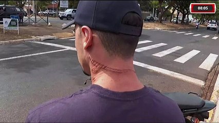 ELETRICISTA FICA COM O PESCOÇO E O ROSTO FERIDOS APÓS SER ATINGIDO POR FIOS SOLTOS, EM RIBEIRÃO PRETO