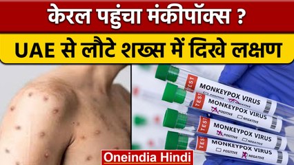 Kerala के एक शख्स में मिले Monkeypox के लक्षण, अभी UAE से लौटा था ये व्यक्ति | वनइंडिया हिंदी|*News