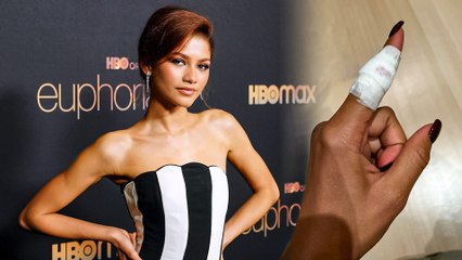 Zendaya Accidently Injured Herself While Cooking