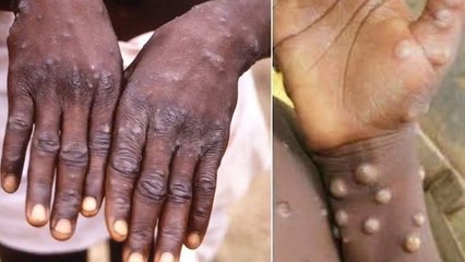 విమాన ప్రయాణికులపై ఆంక్షలు,కేంద్రం అలర్ట్ *National | Telugu OneIndia