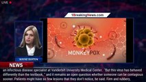 As monkeypox outbreak spreads, CDC pledges more vaccines. Here's what to know. - 1breakingnews.com