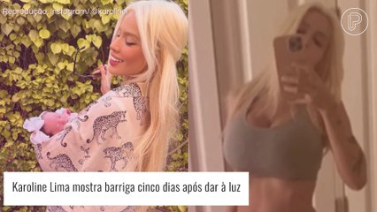 Karoline Lima impressiona seguidores ao mostrar a barriga cinco dias após dar à luz. Confira!